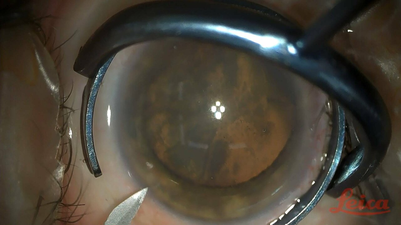 E306 FACO VINALO_3300 11522_V_7200_20210618_165518.jpg