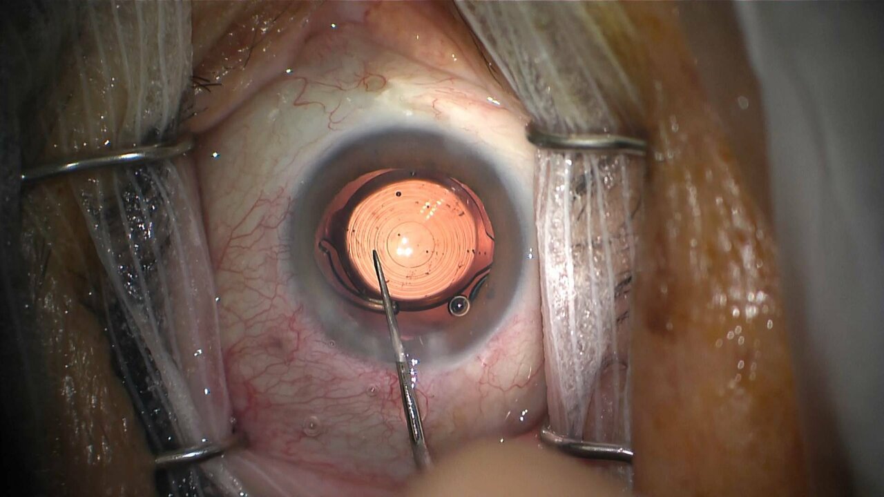 E306 FACO VINALO_3300 11522_V_7200_20210618_165229.jpg